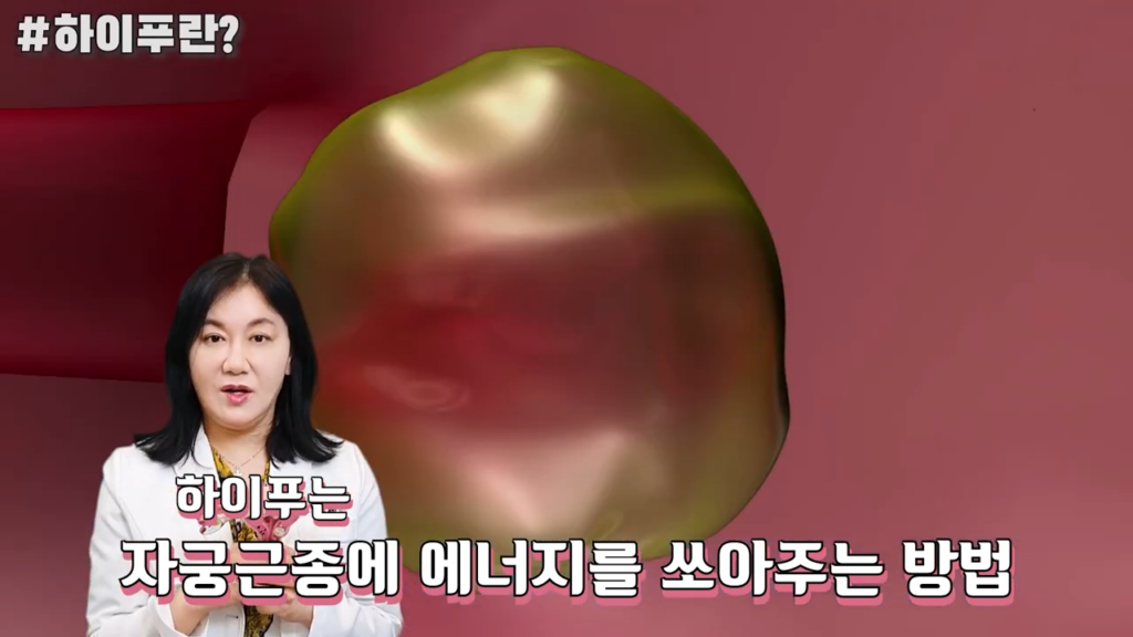 강남산부인과 박정원 원장이 하이푸를 설명하는 사진