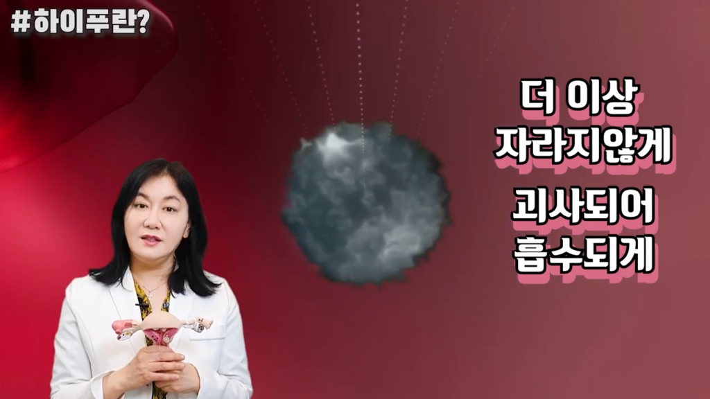 강남산부인과 박정원 원장이 하이푸를 설명하는 사진