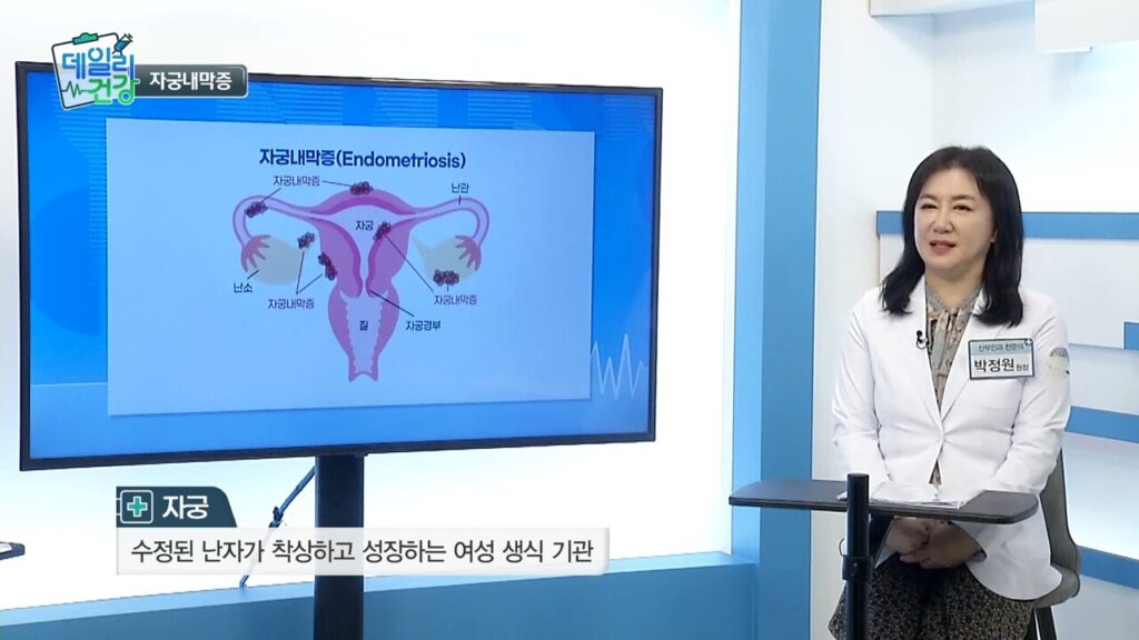 [쿠키 TV 데일리건강] 자궁내막증의 원인과 가설의 연관, 자궁선근증 치료에 대해 신소애여성의원 박정원 원장님 출연한 사진