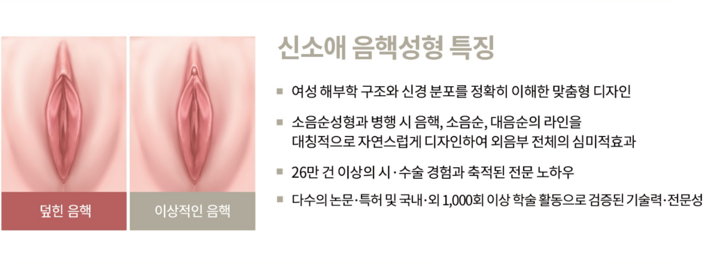 신소애여성의원 음핵성형 특징
