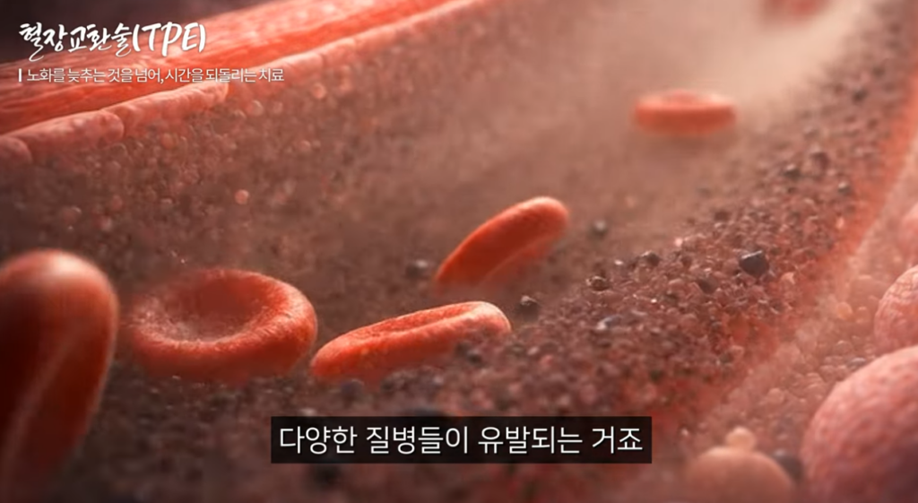 혈장내에 노폐물이 가득 찬 이미지
혈장교환술