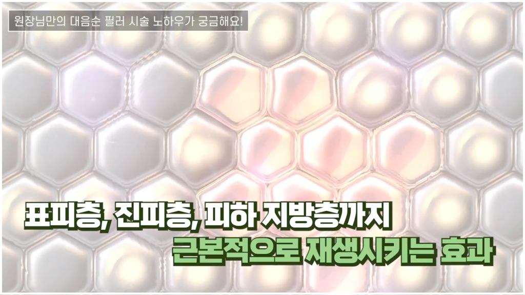 신소애여성의원 대음순필러 시술 노하우 1