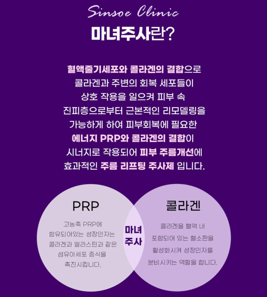 마녀주사의 대해서