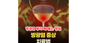 베지코트시술 : 방광염 증상과 치료