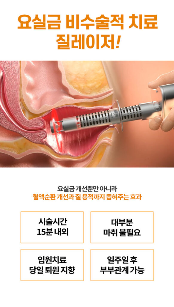 요실금 비수술적치료 질레이저