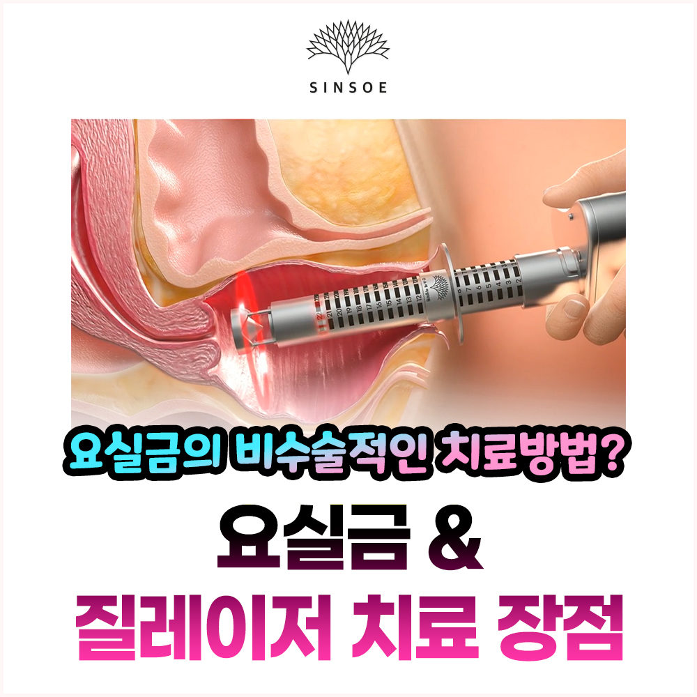 요실금 비수술적인 치료방법 : 질레이저 치료 장점과 원리