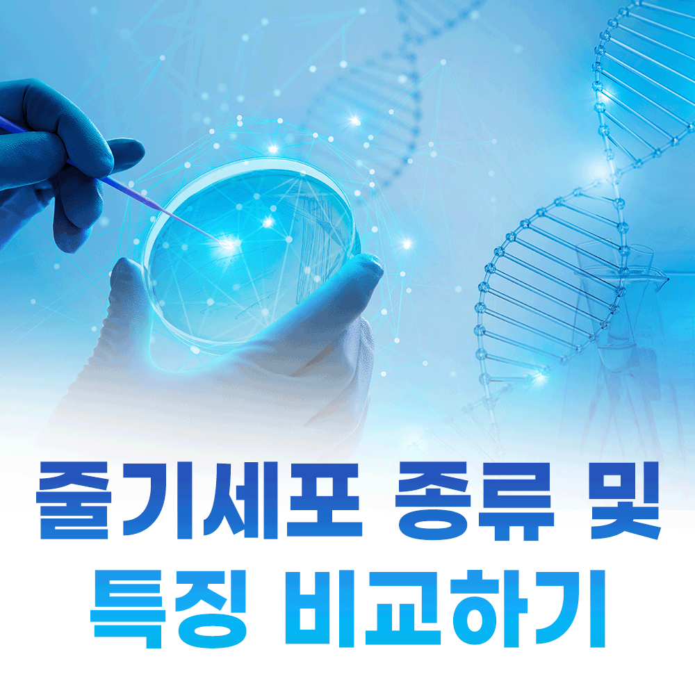 줄기세포종류와 특징 비교