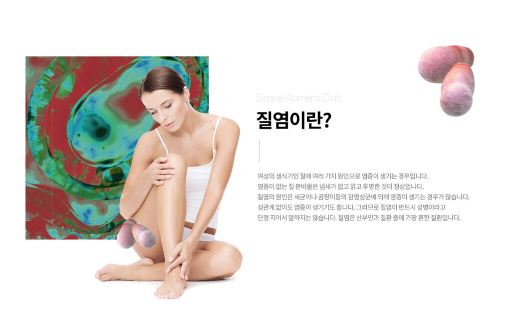 질염 뜻