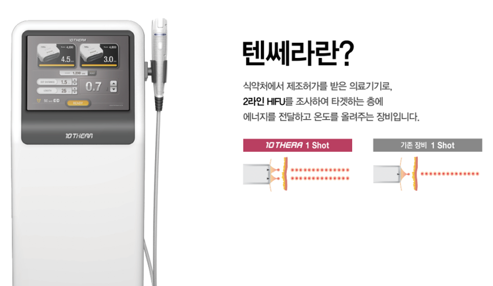 텐쎄라에 대한 사진
