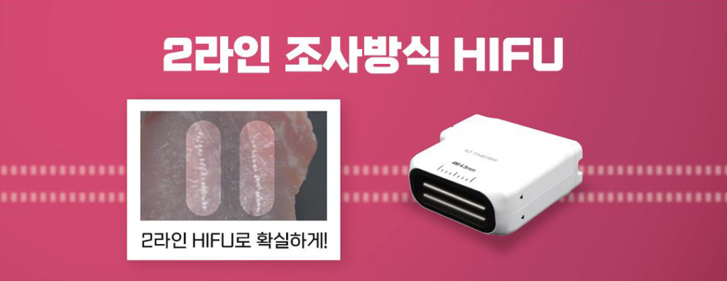 탠쎄라 조사방식