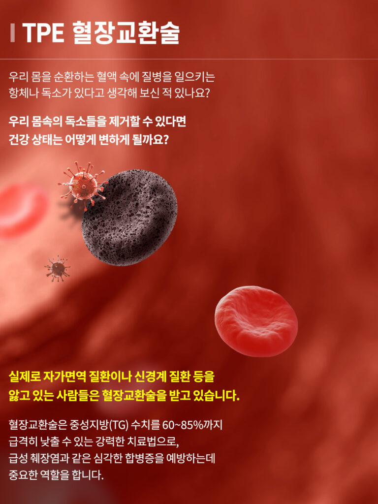 혈장교환술비용