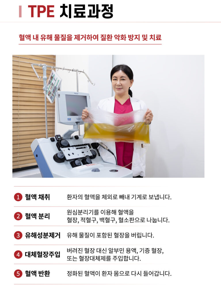 혈장교환술 치료방법