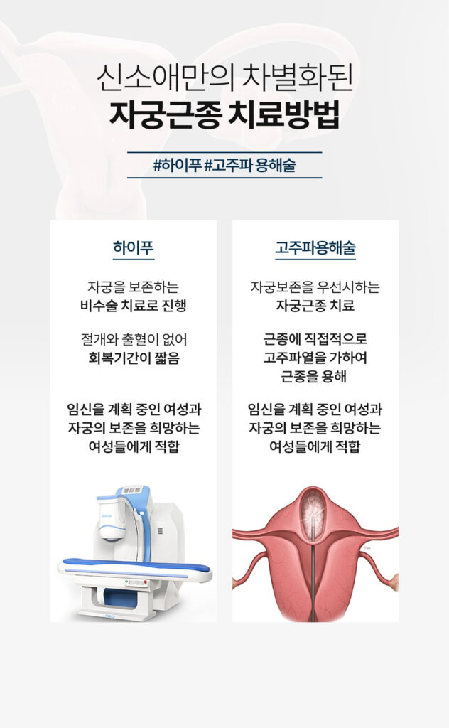 자궁근종 치료 방법