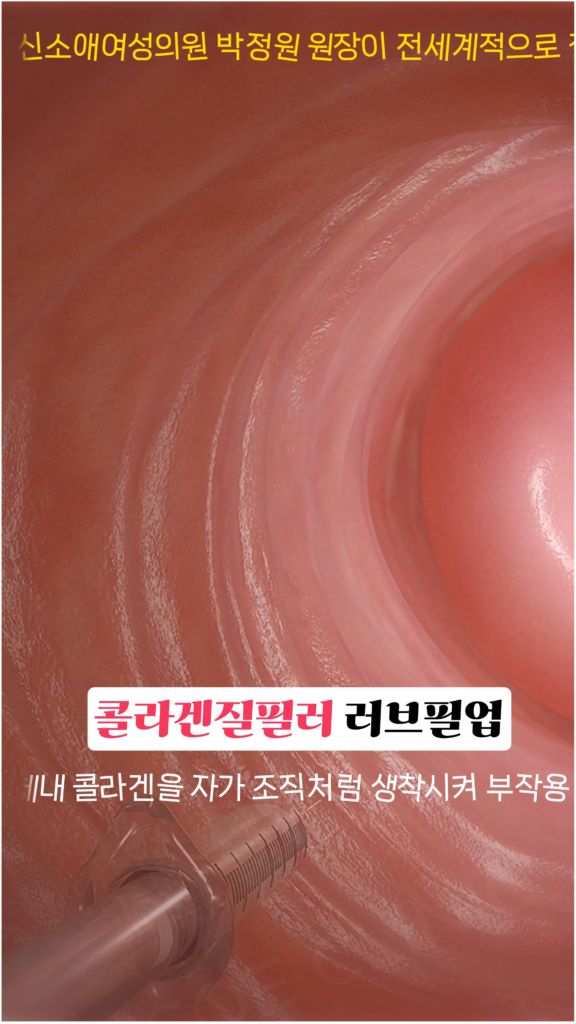 러브필업 시술 과정 1