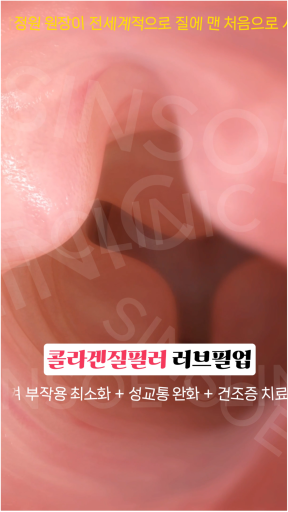 러브필업 시술 과정 4