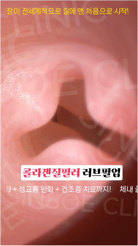 러브필업 시술 과정 5