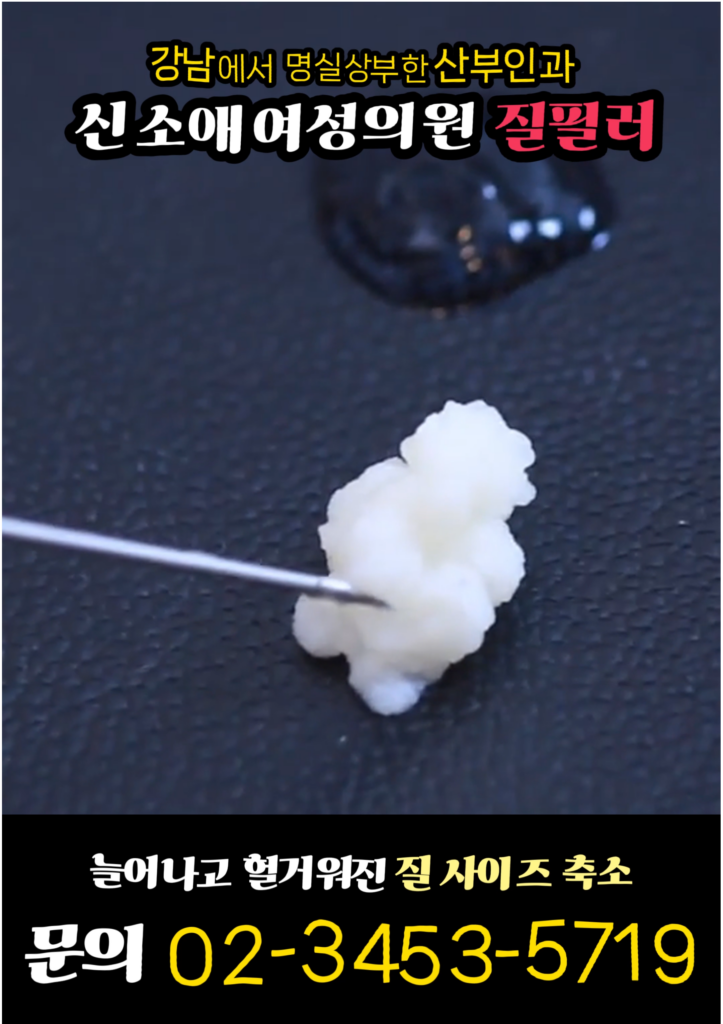 러브필업과 일반질필러의 차이