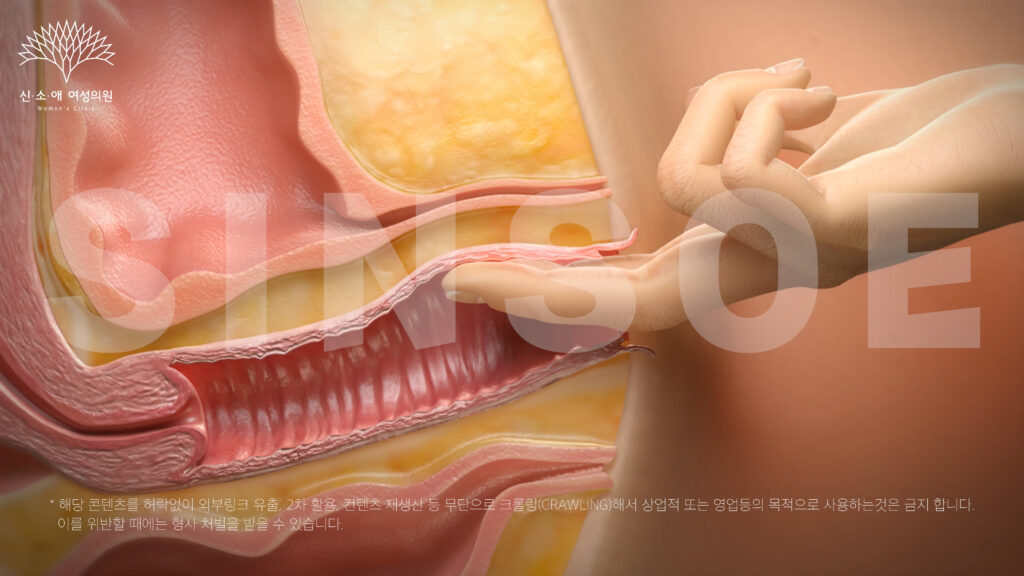 내진하는 사진