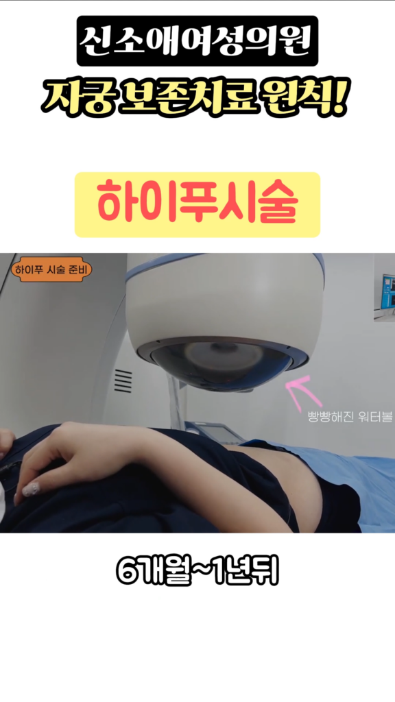 하이푸시술 2