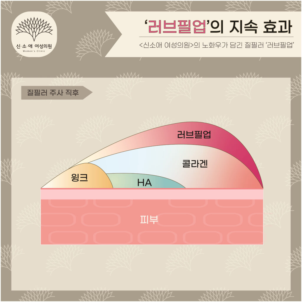 러브필업 효과 주사 직전 