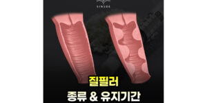 질 조직에 사용하는 필러 유지기간, 종류
