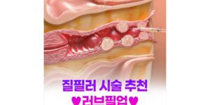질건조증·질이완증, 단순한 노화가 아닙니다. 러브필업 질필러로 질 건강과 삶의 질을 함께 높이는 방법