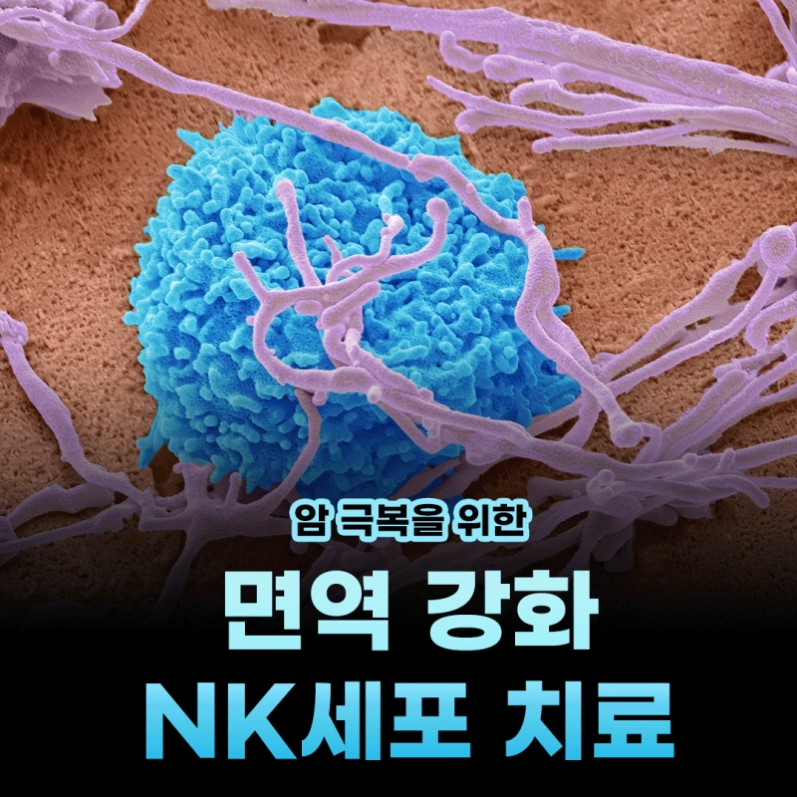 암 재발과 내성 극복을 위한 NK세포 면역 주사 치료 가이드