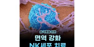 암 극복을 위한 면역 강화 NK세포 치료