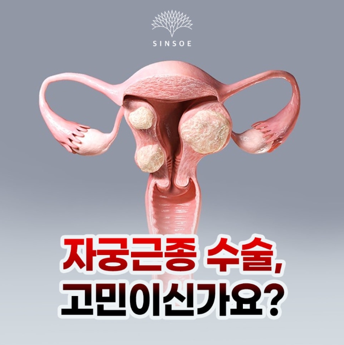 자궁근종 비수술 치료, 하이푸와 고주파용해술 알아보기