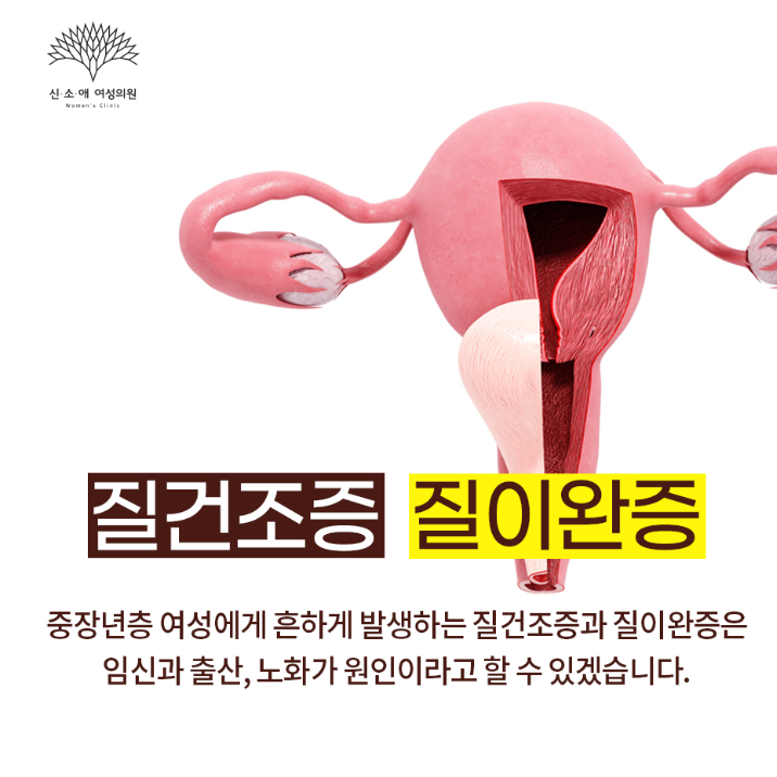질건조증 질이완증 차이 